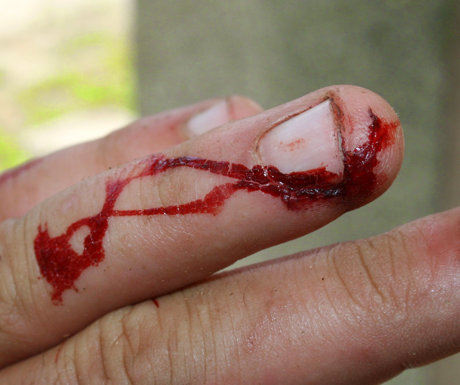 Dried blood from my little cut Dried blood from my little cut