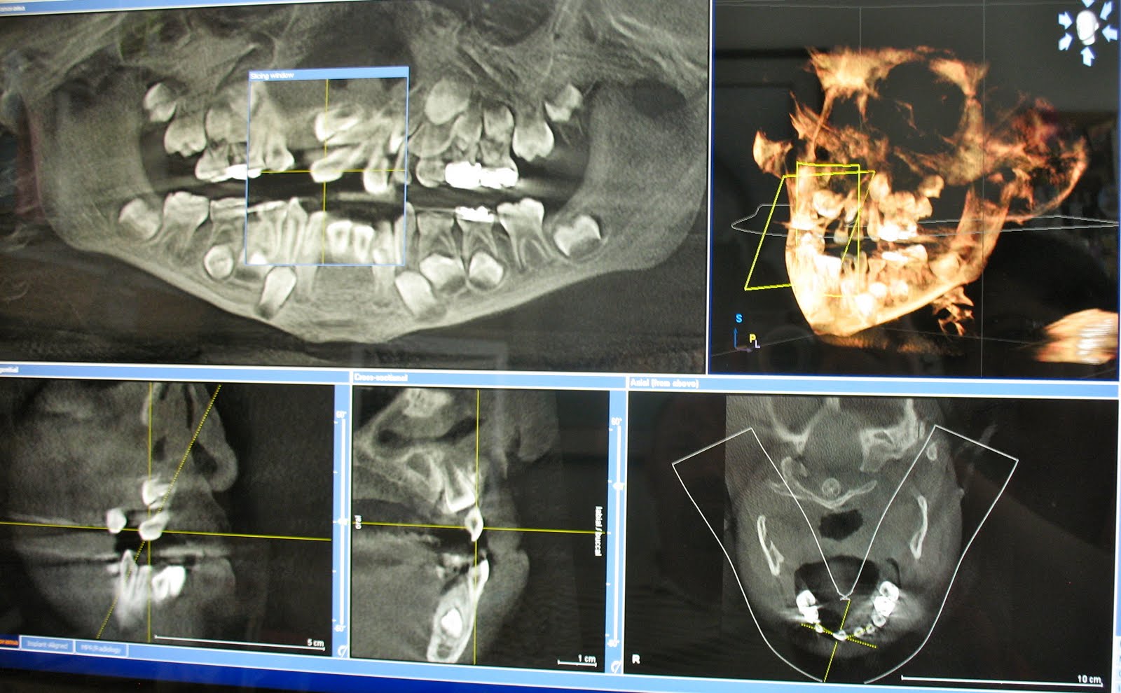 dental ct scan cost