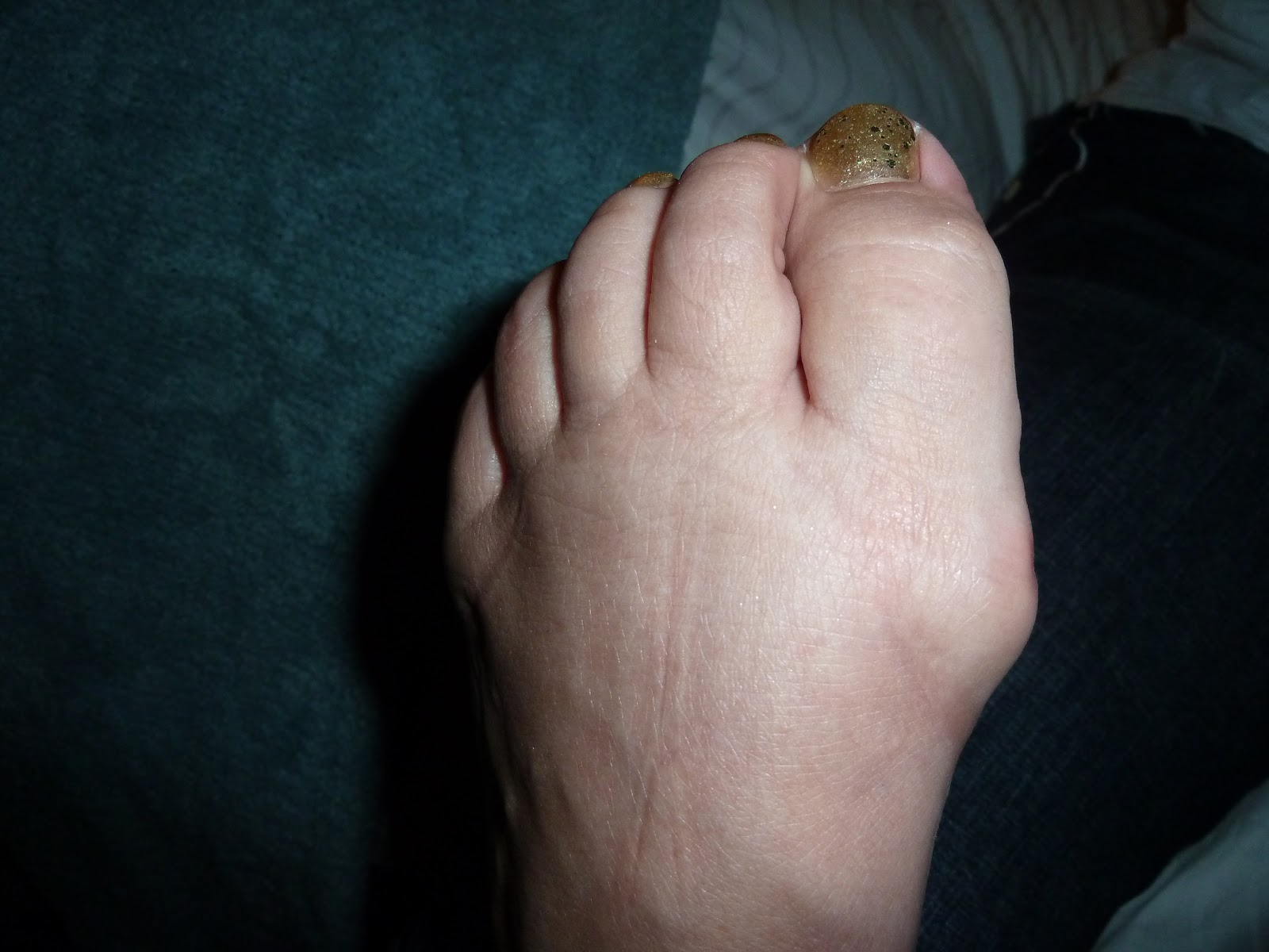 Lower Back Pain Causes