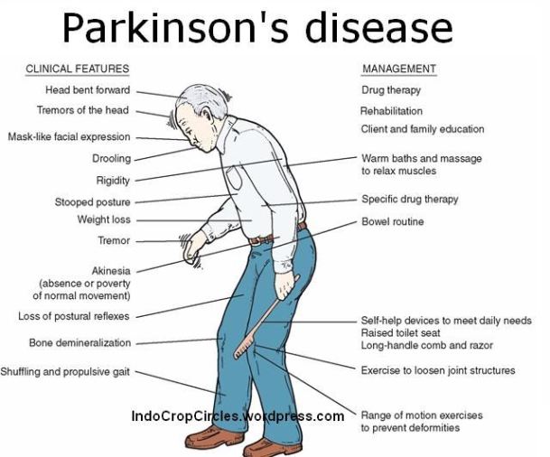 Apa Itu Commissioning Tests For Parkinson's Disease IMAGESEE