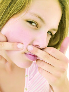 Mascarilla para el acne