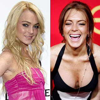 Lindsay Lohan Nose Job