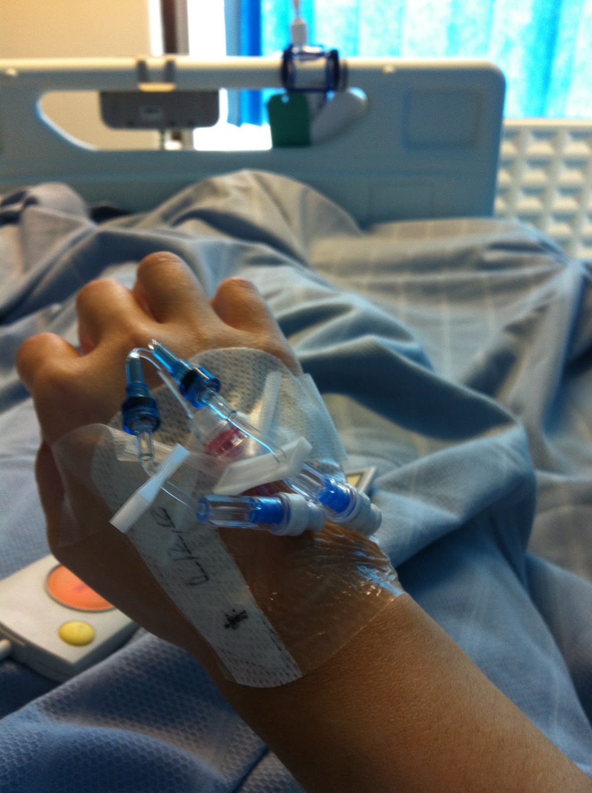 A Guide to Surviving Orthognathic Surgery Titanium Plates and Screws