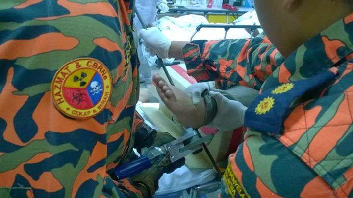 Kaki Wanita Tercucuk Besi female legs punctured metal, iron punctured foot, Ngeri! Kaki Wanita Tercucuk Besi, Kaki Tercucuk Paku, Besi Tembus Kaki,
