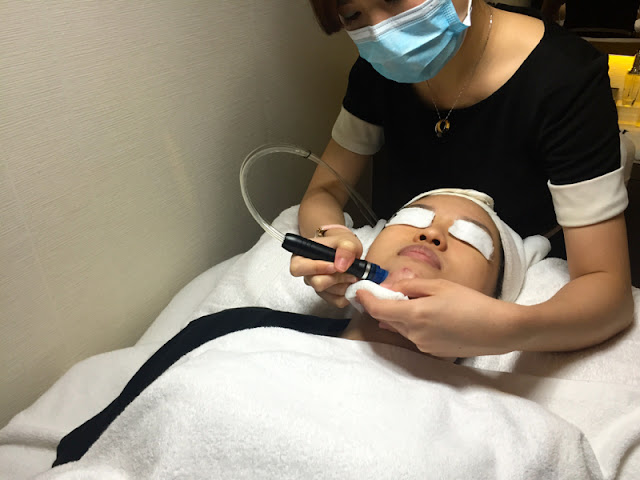 Simply Aesthetics Oxycious Facial Treatment Review Lunarrive Singapore Lifestyle Blog