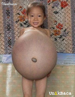 Anak Kecil Hamil