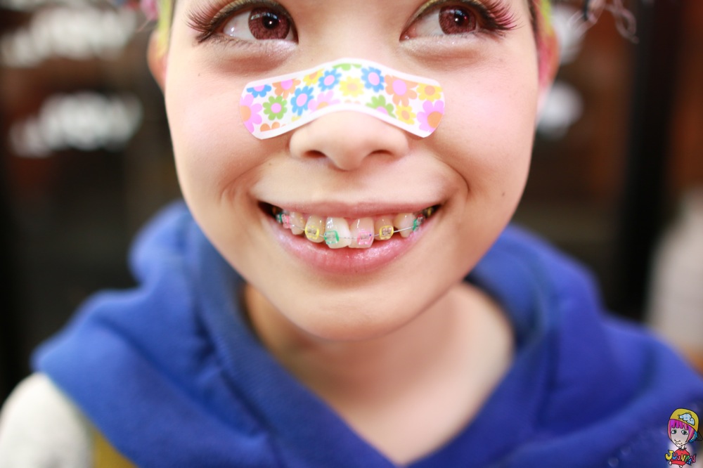 HARAJUKU KIDS Haruka Kurebayashi's Colorful Braces!!