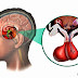 Kelenjar Hipofisa (Pituitary) thumbnail