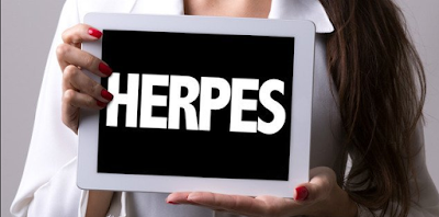 Foto obat antivirus herpes genital