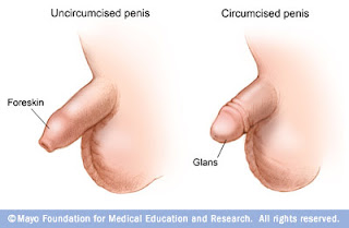 Circumcised or Uncircumcised