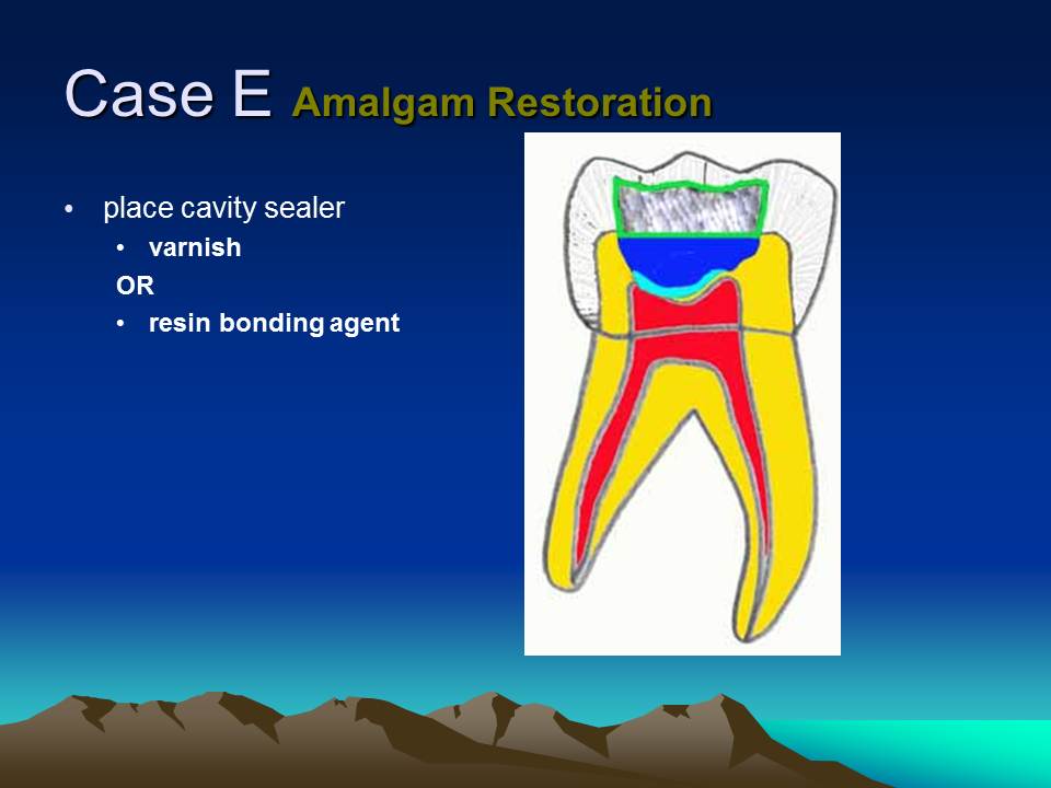 Dentistry Sealers, Liners and Bases