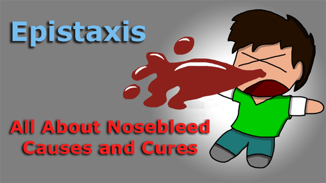 All About Nosebleed Causes and Cures All About Nosebleed Causes and Cures