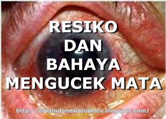 Bahaya mengucek mata iritasi mata, katarak, kornea