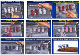 Mutia Rahmatika Pewarnaan Bta