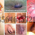 Artikel Obat AmbeJOSS Buat Sakit Wasir thumbnail