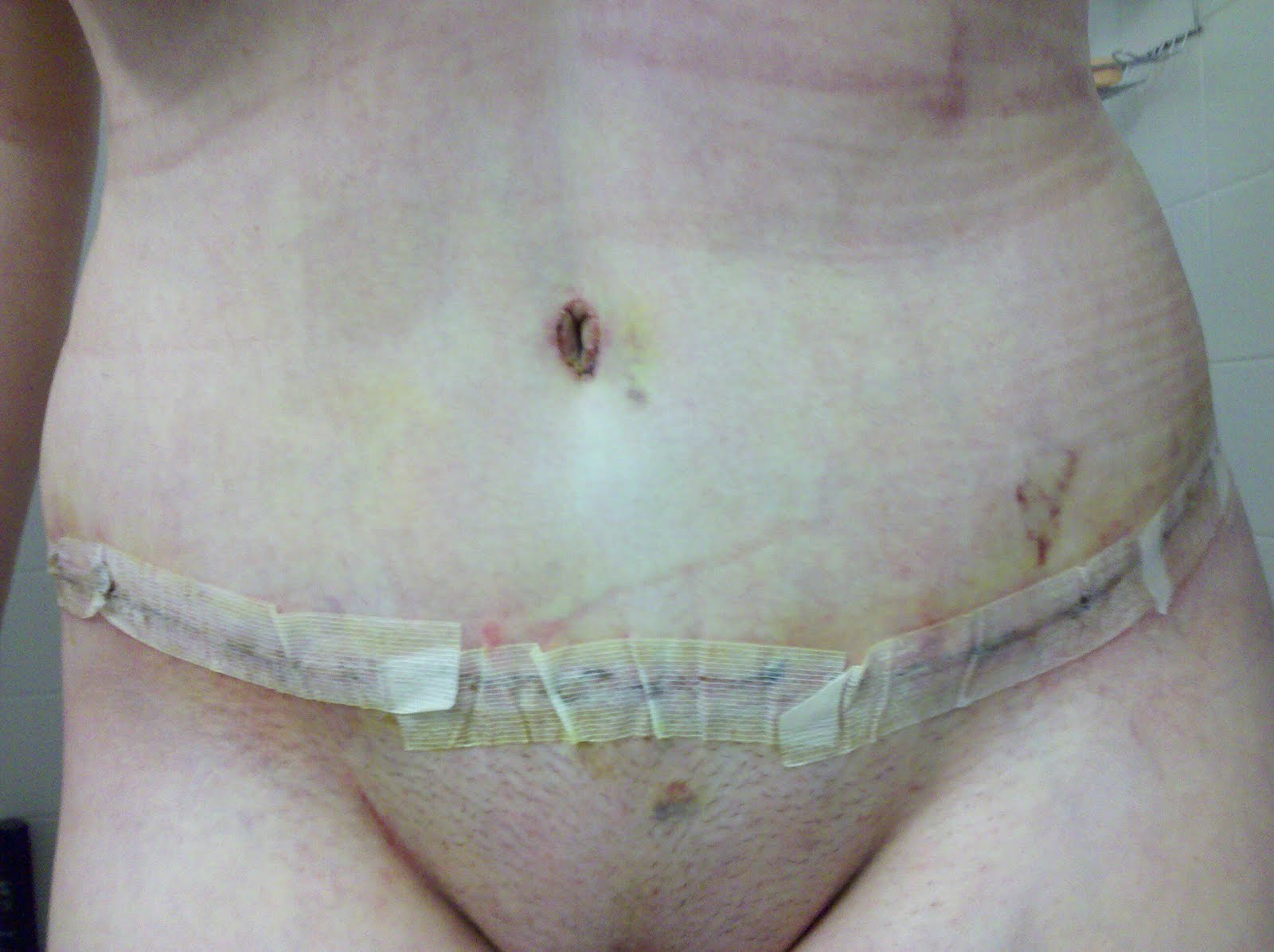 prostituee tremblay en france