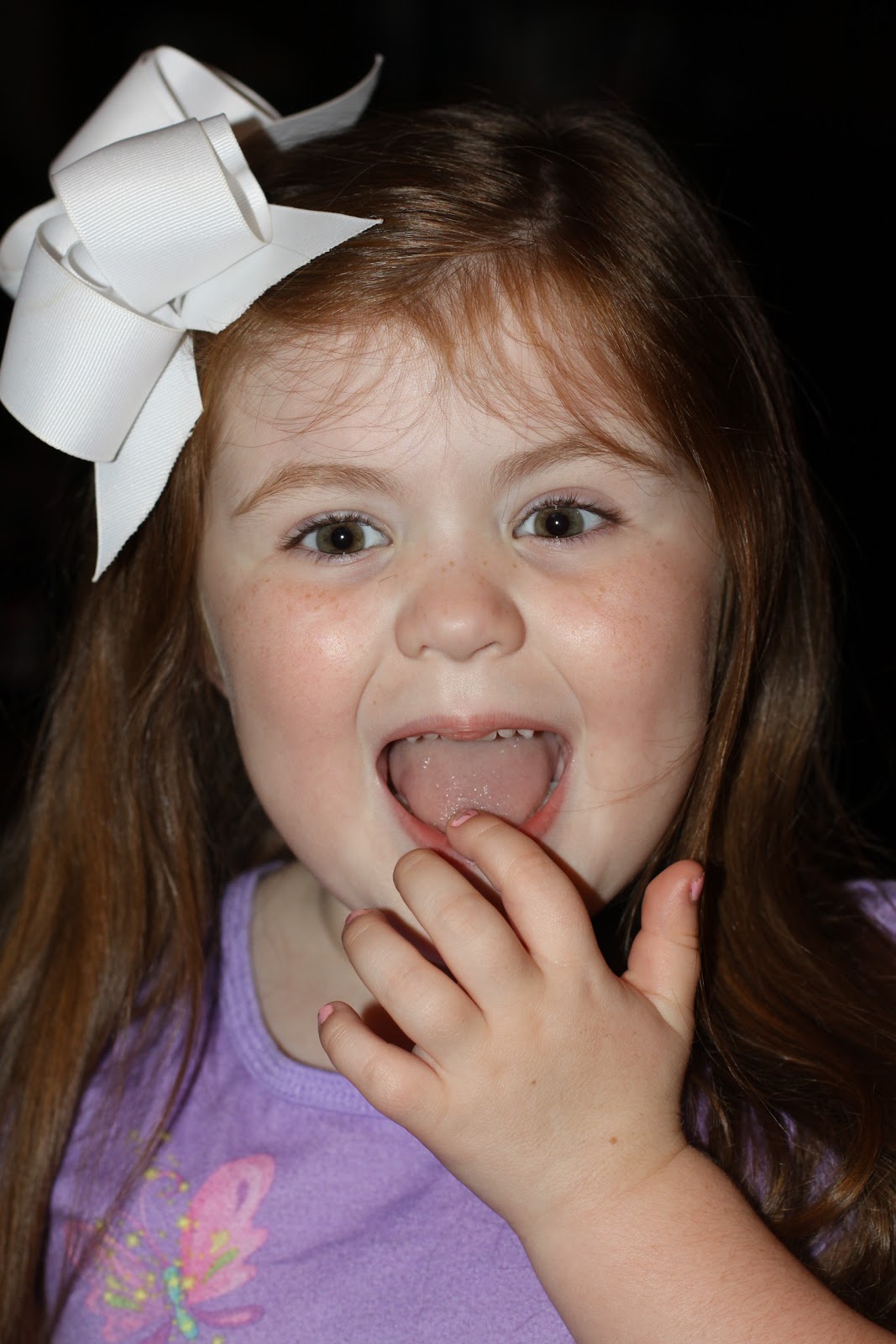 Life as a Frazier Loose Tooth