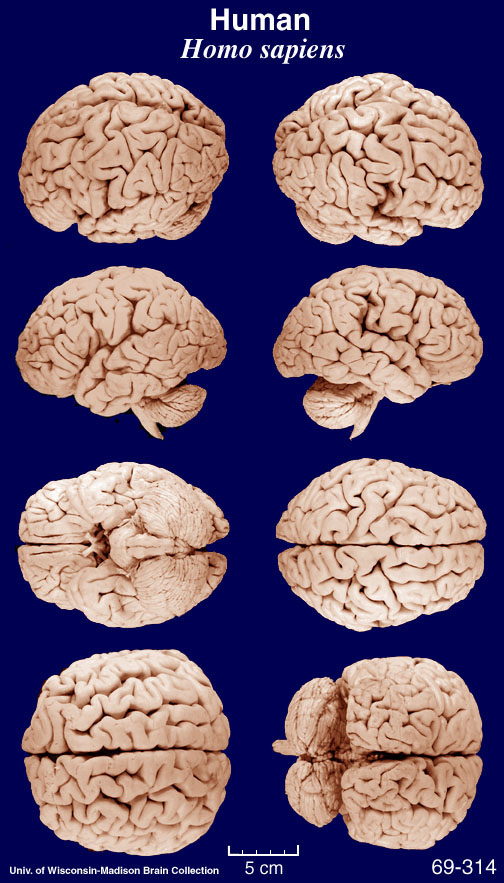 Cat Brains Similar To Human Brains Cat Brains Similar To Human Brains