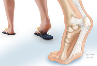 Heel Pain