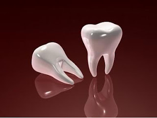 Dental Implants New York Dental Implants New York