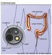 colonoscopy digestive disorders unnecessary procedures limited webmd medical problems cents cardiologists basics performed