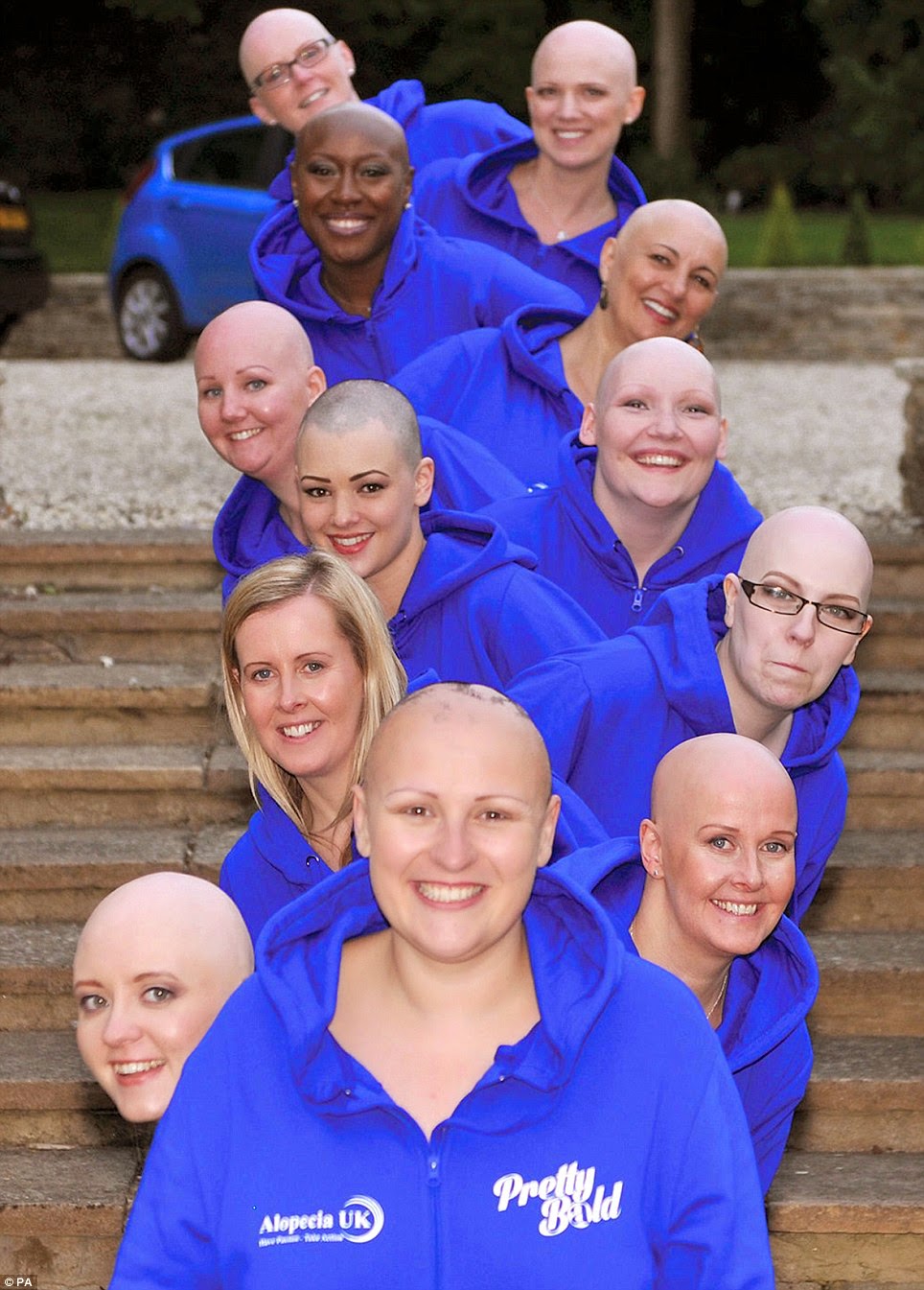 EGistOnline Magazine: Bald Is Beautiful: 12 Hairless Women 