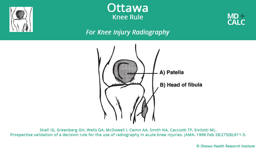 Fisioterapeuta Luís Miguel Brazão Gouveia Ottawa Knee Rule