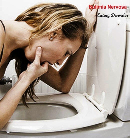 Recovering: Anorexia Nervosa And Bulimia Nervosa