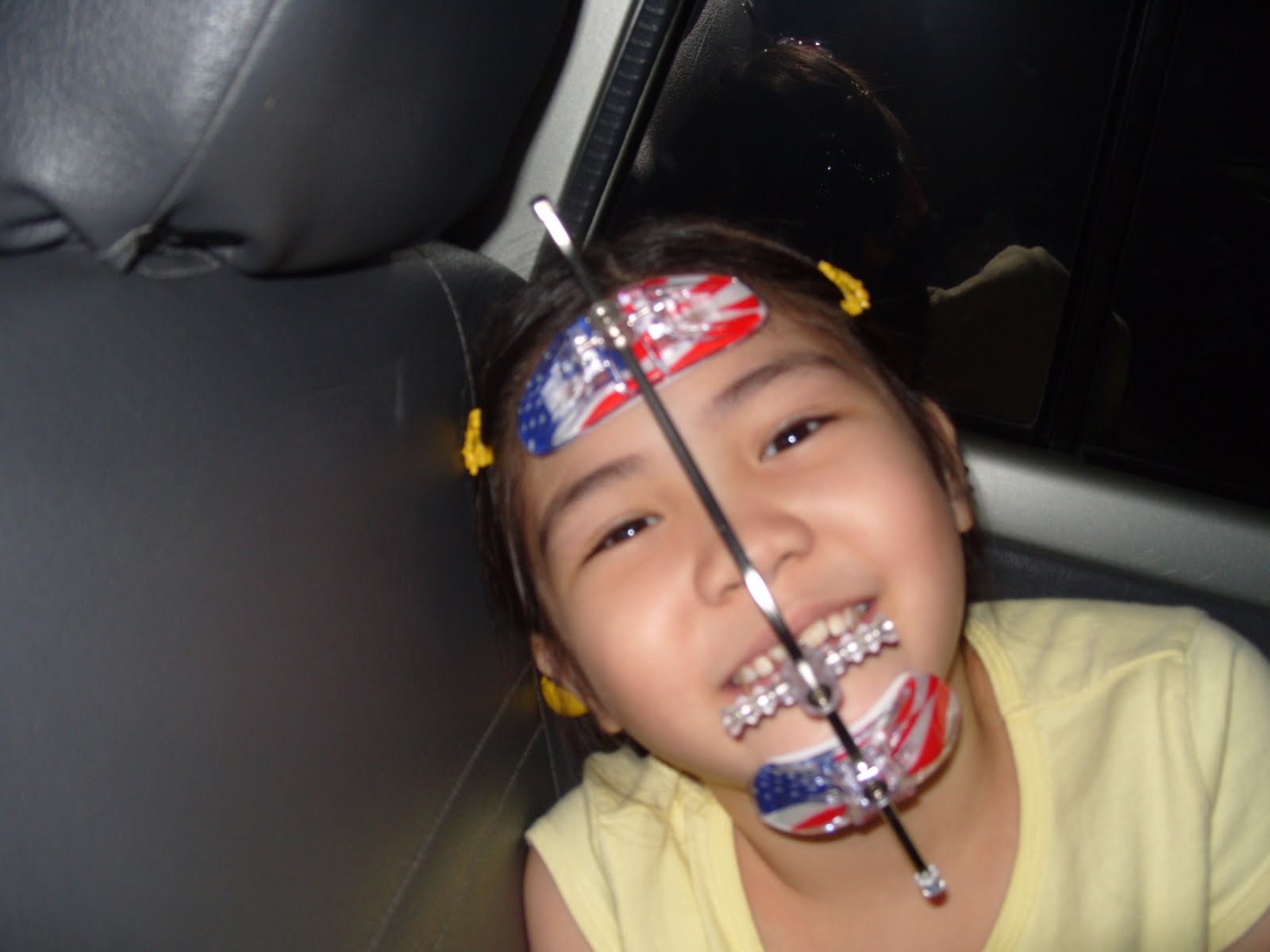 Hyped Rave ARGUMENTS Hukum Memasang Kawat Gigi