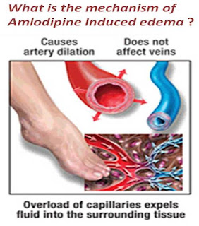 why does amlodipine cause edema