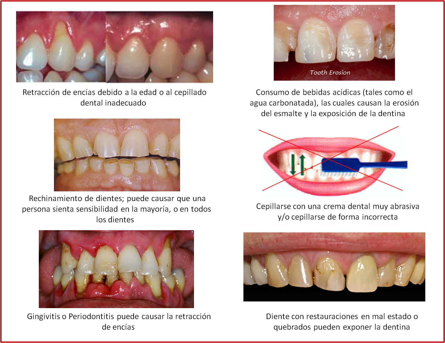 ¿Sensibilidad en los dientes? TRUE DENT