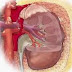Biến chứng và cách điều trị bệnh thận hư Biến chứng và cách điều trị bệnh thận hư
