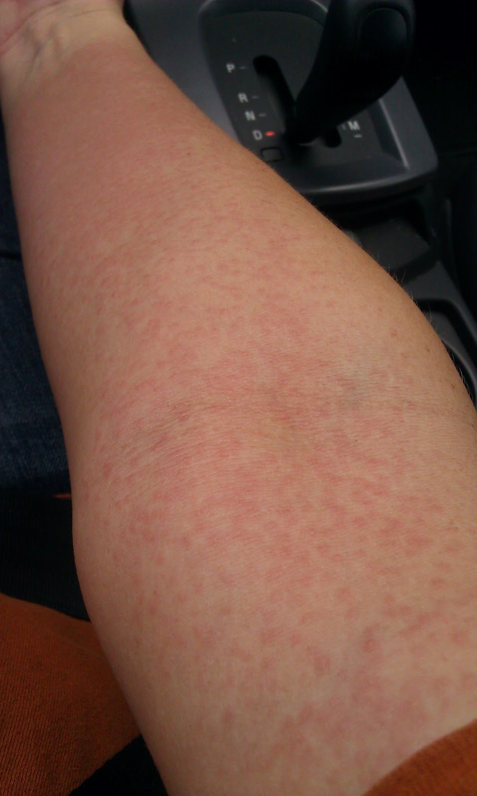 A Melon Strolling on Two Tendrils Don't be Rash