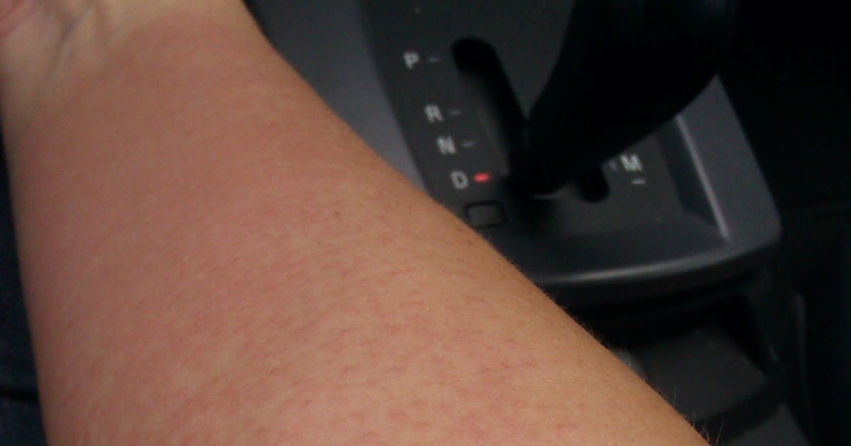 A Melon Strolling on Two Tendrils Don't be Rash