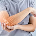 10 questões importantes sobre a Osteoporose