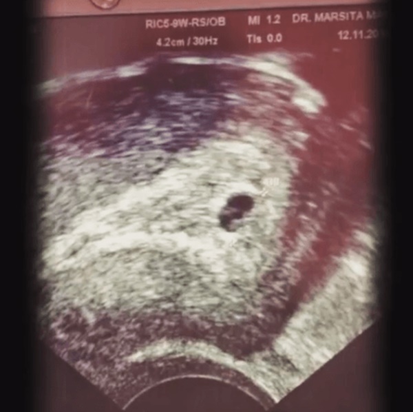 Siti Nurhaliza Kongsi Gambar Ujian Kehamilan Dan Imbasan Ultrasound Bayinya... SAYU!! Siti Nurhaliza Kongsi Gambar Ujian Kehamilan Dan Imbasan Ultrasound Bayinya... SAYU!!