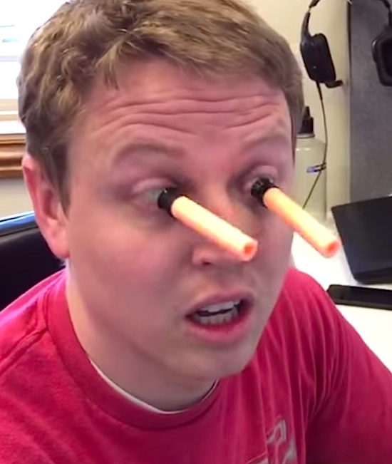 Nerf gun to the eye Art'einsky