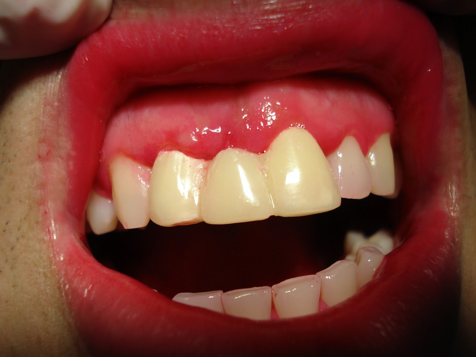 Medical & Dental Solutions XXI: Recomendaciones odontológicas