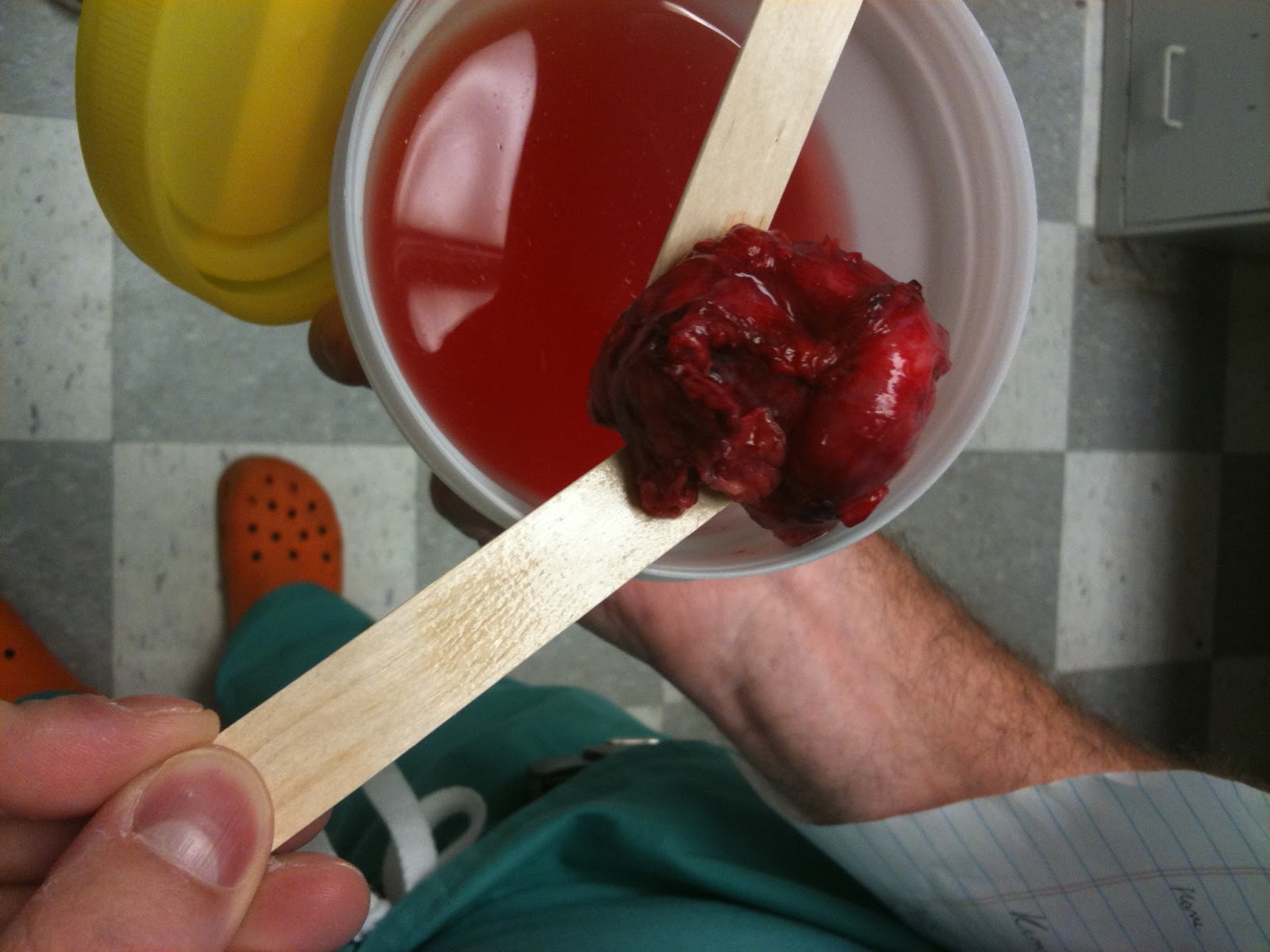Dog Adrenal Gland