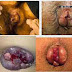 Ambeclear Tidak di Jual di Apotik Umum thumbnail