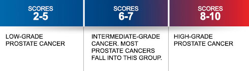 psa levels and prostate cancer info all articles psa levels chart