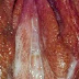 Obat sifilis ampuh thumbnail