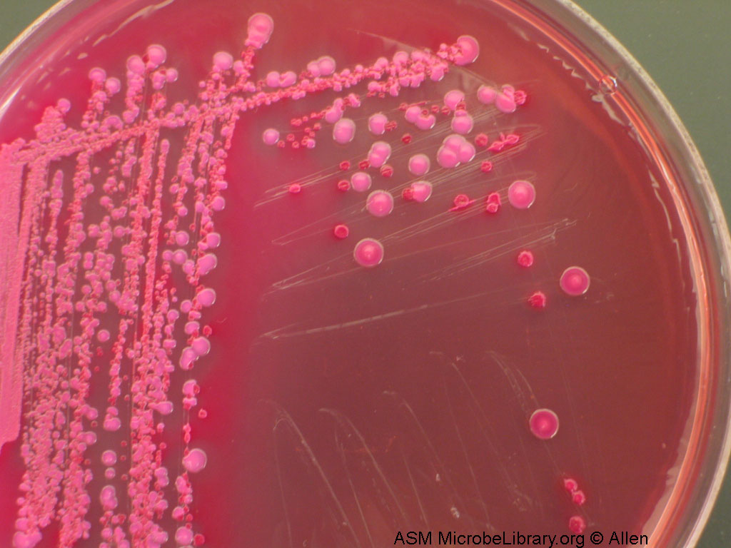 Чем и как лечат klebsiella pneumoniae в моче Чем и как лечат klebsiella pneumoniae в моче