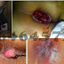 Kandungan Ampuh Daun Ungu dalam Tiap Kapsul Ambeclear Obati Wasir thumbnail