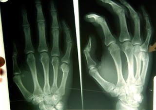 x ray tech school