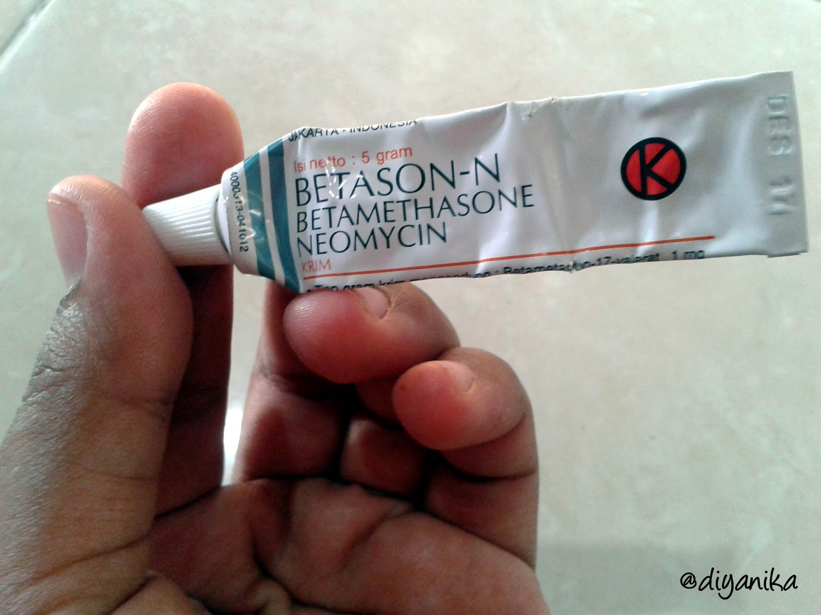 Ini Cara Mengatasi Biang Keringat pada Bayi Diyanika Journal