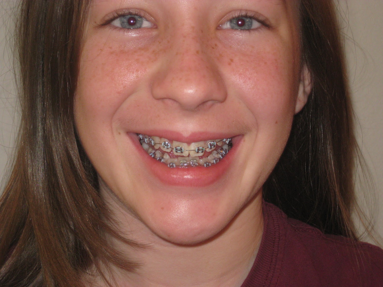 The Early family Maddy has braces!!