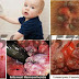 Obat Resep Dokter Wasir Online thumbnail