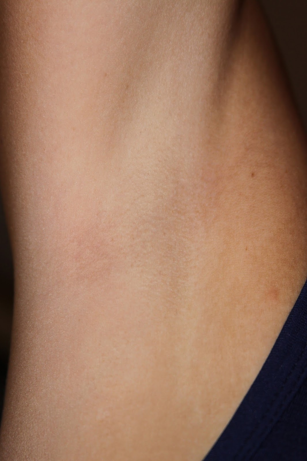 Pubic Hair Before And After Waxing | genital waxing before and after pubic hair before and Pubic Hair Before And After Waxing | genital waxing before and after pubic hair before and