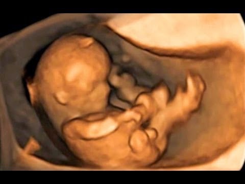 Resultado de imagen de ecografia 4d bebe